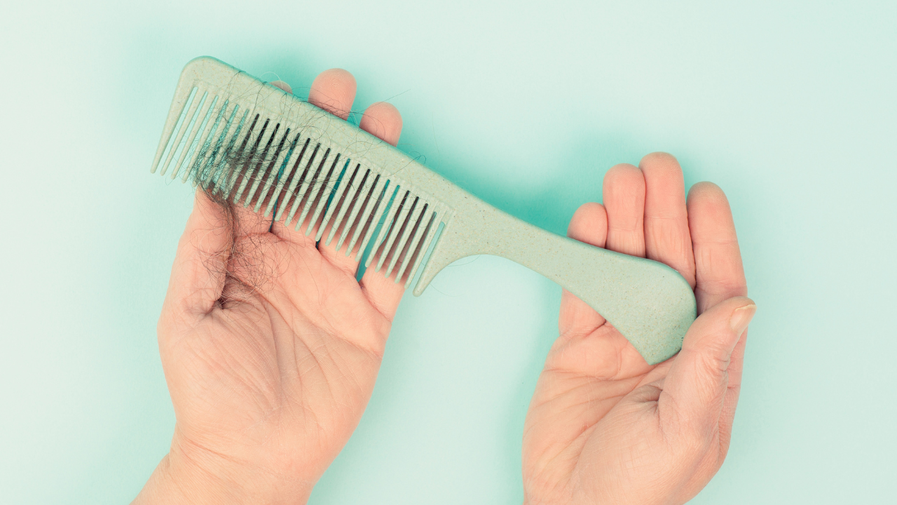 Comb with hair loss, health problem, issue of aging, alopecia areata by stress or infection, hairbrush. Image Credit: Adobe Stock Images/Berit Kessler