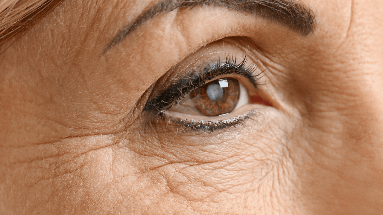 Cataract concept. Senior woman's eye, closeup. Image Credit: Adobe Stock Images/Africa Studio