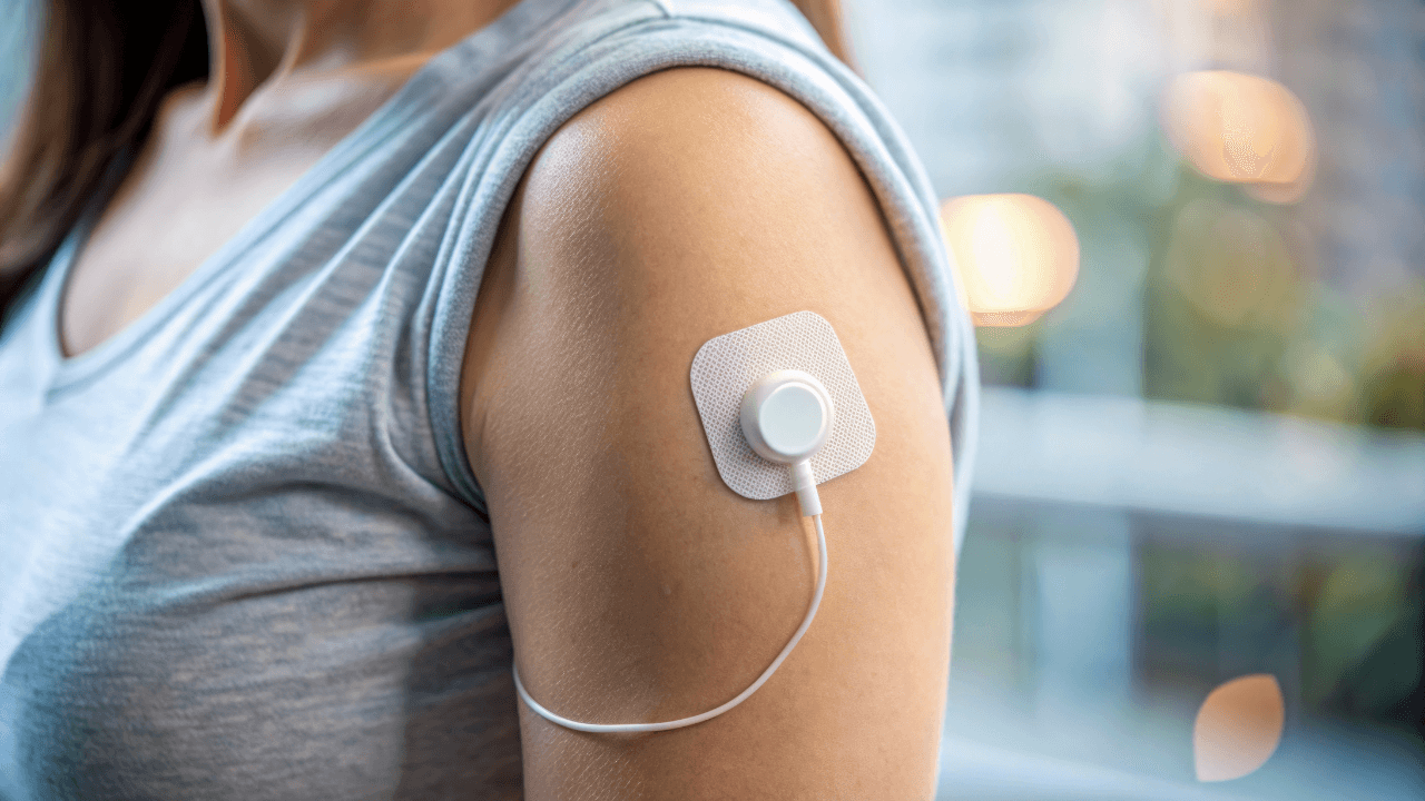 Close-up of a continuous glucose monitor device being attached to an arm, with adhesive strips and sensor visible, on a blurred background. Image Credit: Adobe Stock Images/Wanlop