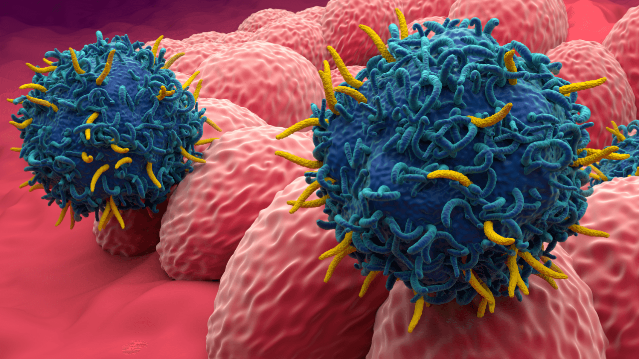 CAR T cell therapy in Endometrial cancer - closeup view 3d illustration. Image Credit: Adobe Stock Images/LASZLO